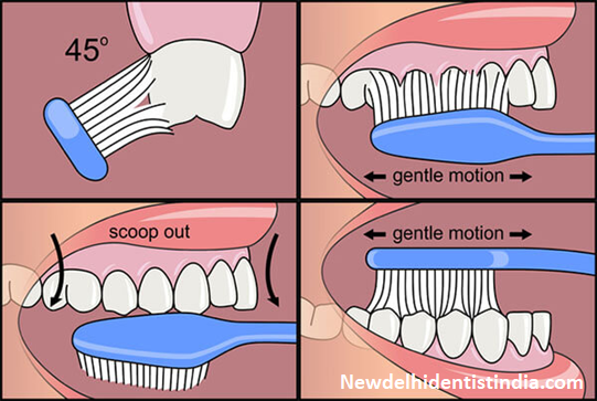 Best Practices for Healthy Teeth